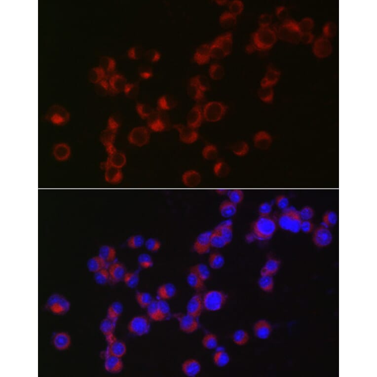 Immunofluorescence - Anti-Doublecortin Antibody (A13291) - Antibodies.com