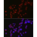 Immunofluorescence - Anti-Doublecortin Antibody (A13291) - Antibodies.com