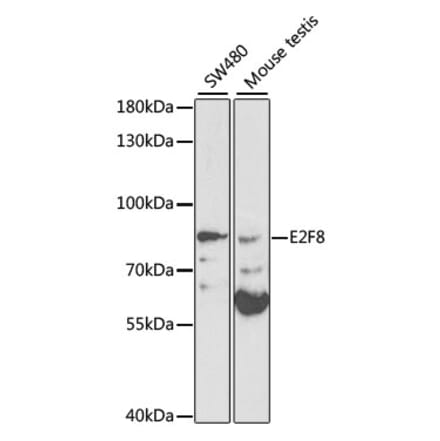 Western Blot - Anti-E2F8 Antibody (A13293) - Antibodies.com