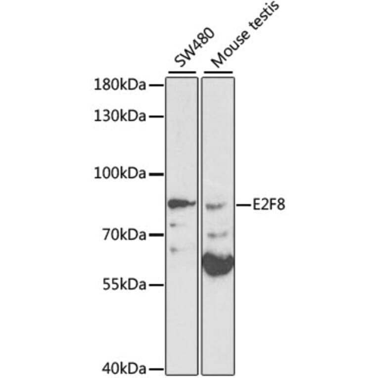 Western Blot - Anti-E2F8 Antibody (A13293) - Antibodies.com