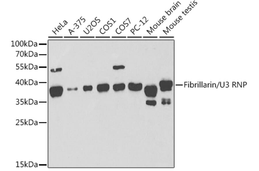 Western Blot - Anti-Fibrillarin Antibody (A13296) - Antibodies.com