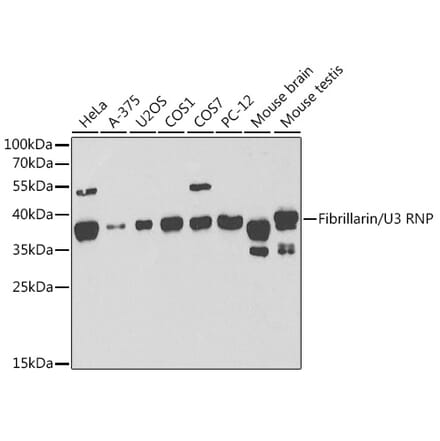 Western Blot - Anti-Fibrillarin Antibody (A13296) - Antibodies.com