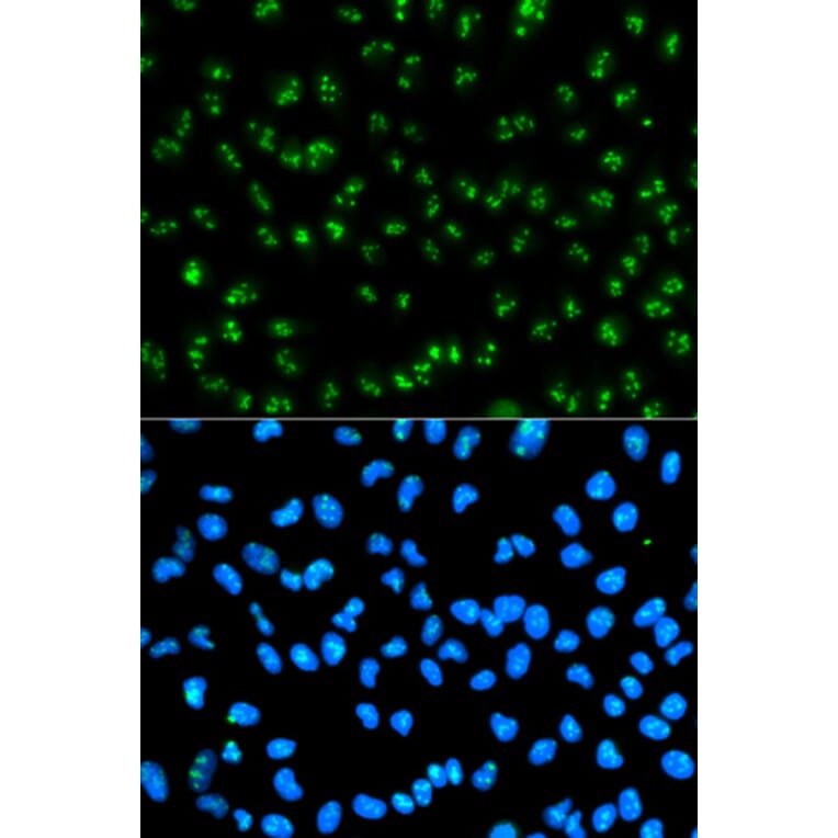 Immunofluorescence - Anti-Fibrillarin Antibody (A13296) - Antibodies.com