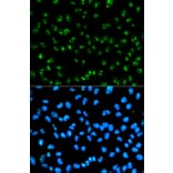 Immunofluorescence - Anti-Fibrillarin Antibody (A13296) - Antibodies.com