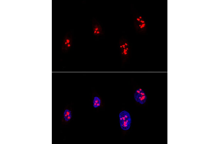 Immunofluorescence - Anti-Fibrillarin Antibody (A13296) - Antibodies.com