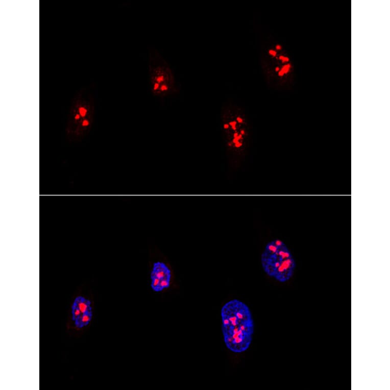 Immunofluorescence - Anti-Fibrillarin Antibody (A13296) - Antibodies.com