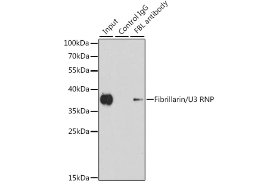 Immunoprecipitation - Anti-Fibrillarin Antibody (A13296) - Antibodies.com