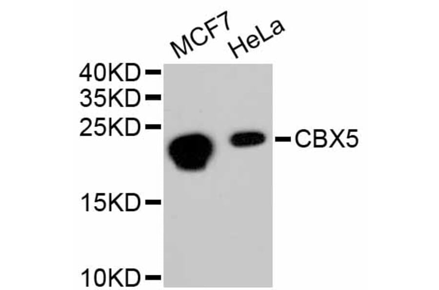 Western Blot - Anti-CBX5 Antibody (A11365) - Antibodies.com