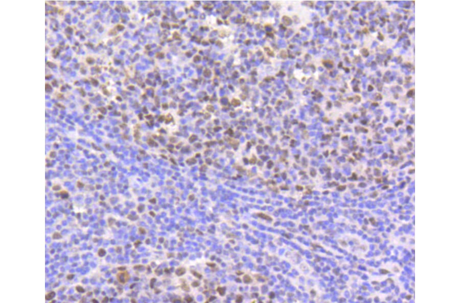 Immunohistochemistry - Anti-CBX5 Antibody (A11365) - Antibodies.com