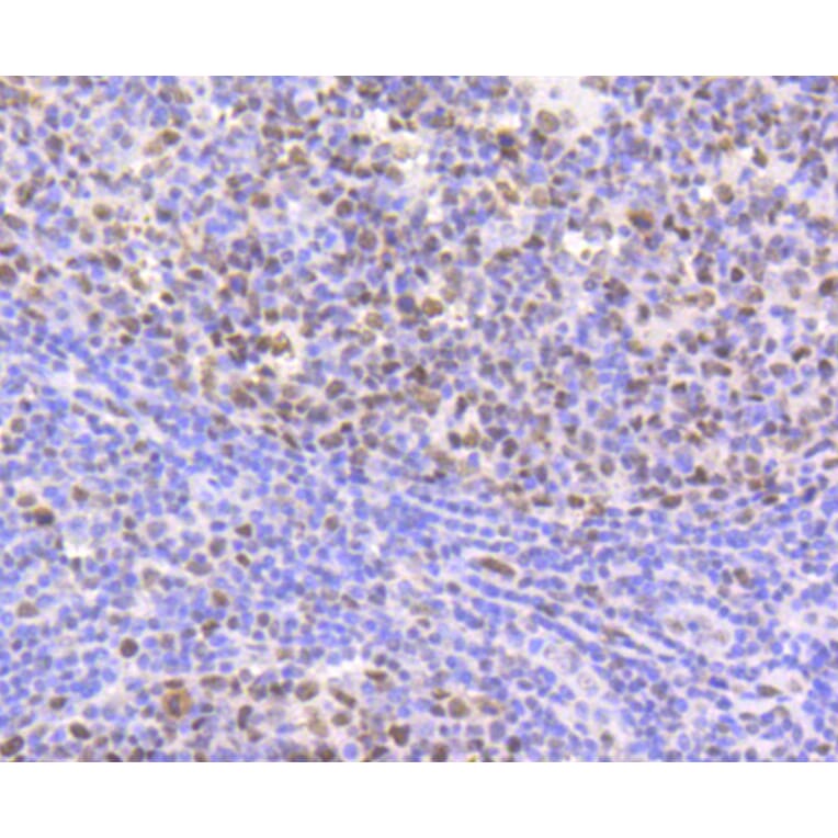 Immunohistochemistry - Anti-CBX5 Antibody (A11365) - Antibodies.com