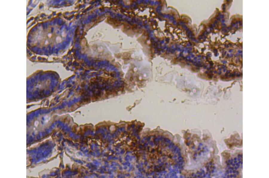 Immunohistochemistry - Anti-BBC3 Antibody (A11374) - Antibodies.com