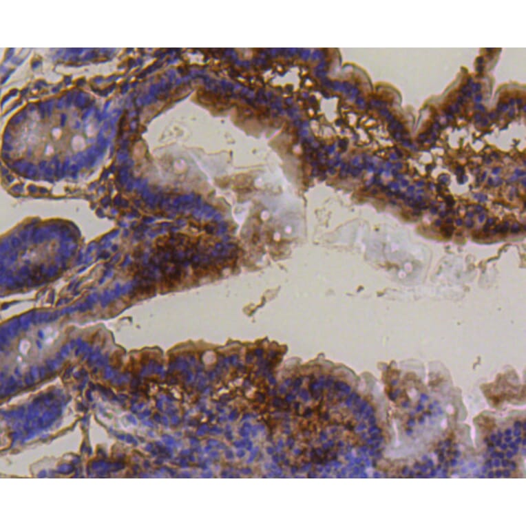 Immunohistochemistry - Anti-BBC3 Antibody (A11374) - Antibodies.com