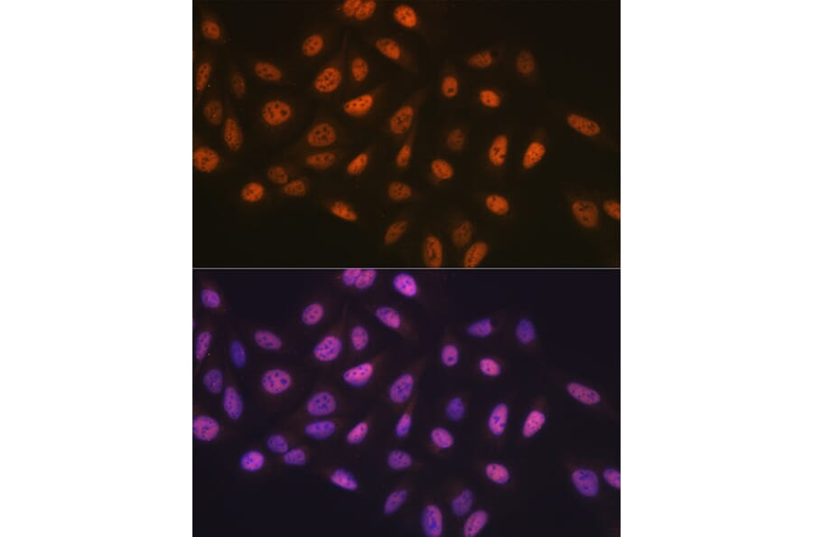 Immunofluorescence - Anti-MCM7/PRL Antibody (A13300) - Antibodies.com