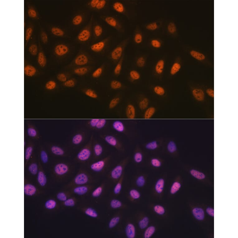 Immunofluorescence - Anti-MCM7/PRL Antibody (A13300) - Antibodies.com