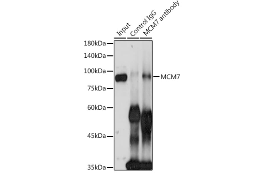 Western Blot - Anti-MCM7/PRL Antibody (A13300) - Antibodies.com