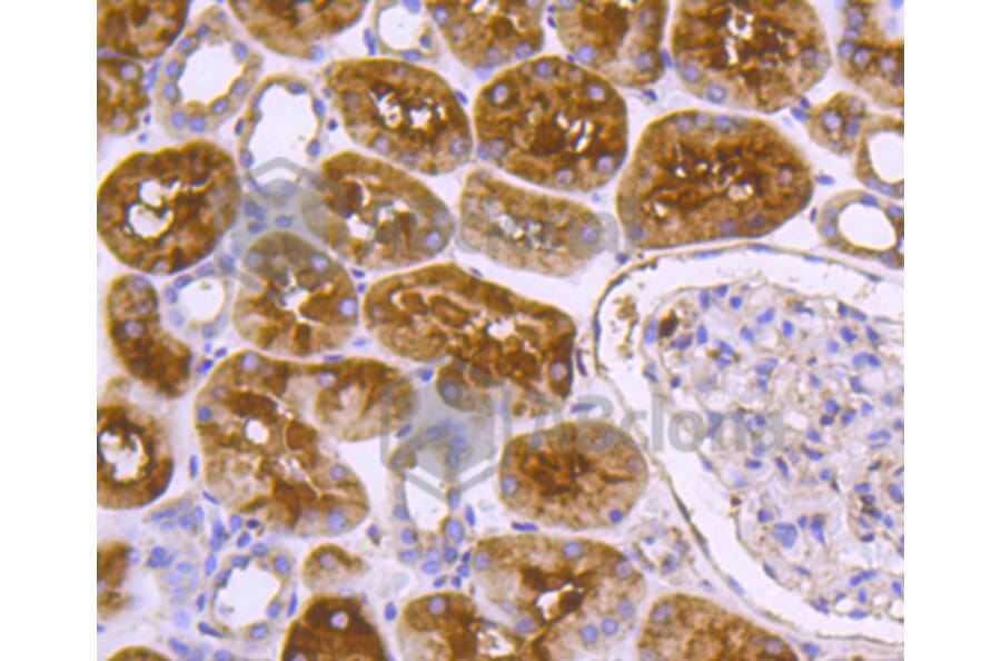 Immunohistochemistry - Anti-DNAJC15 Antibody (A11380) - Antibodies.com
