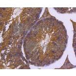 Immunohistochemistry - Anti-DNAJC15 Antibody (A11380) - Antibodies.com