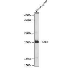 Western Blot - Anti-RAC2 Antibody (A13303) - Antibodies.com