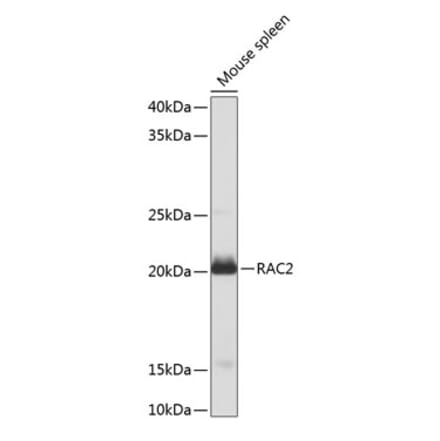 Western Blot - Anti-RAC2 Antibody (A13303) - Antibodies.com