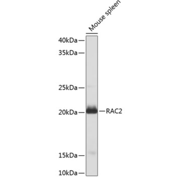 Western Blot - Anti-RAC2 Antibody (A13303) - Antibodies.com