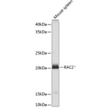 Western Blot - Anti-RAC2 Antibody (A13303) - Antibodies.com