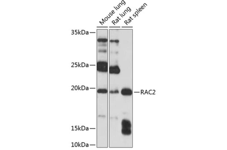 Western Blot - Anti-RAC2 Antibody (A13303) - Antibodies.com
