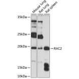 Western Blot - Anti-RAC2 Antibody (A13303) - Antibodies.com