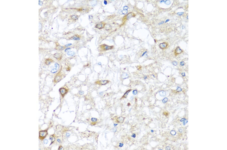 Immunohistochemistry - Anti-RAC2 Antibody (A13303) - Antibodies.com