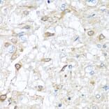 Immunohistochemistry - Anti-RAC2 Antibody (A13303) - Antibodies.com