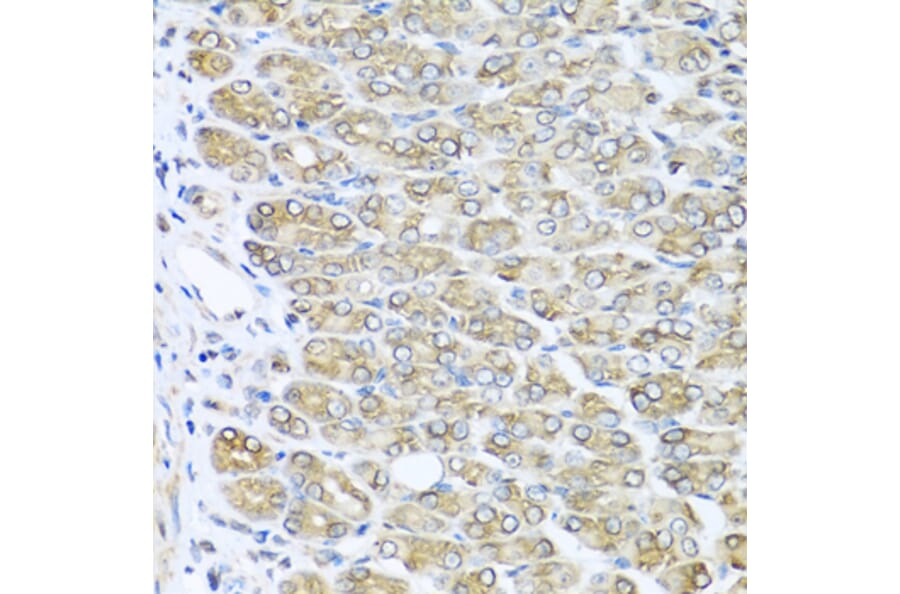 Immunohistochemistry - Anti-RAC2 Antibody (A13303) - Antibodies.com
