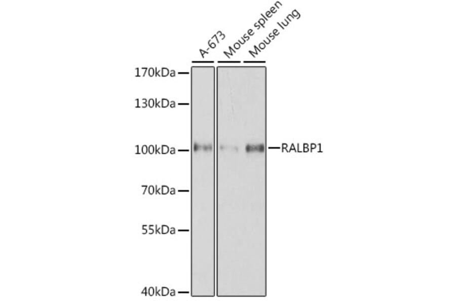 Western Blot - Anti-RALBP1 Antibody (A13307) - Antibodies.com