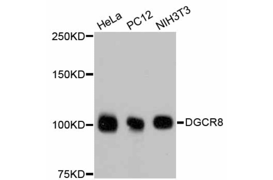 Western Blot - Anti-DGCR8 Antibody (A11404) - Antibodies.com
