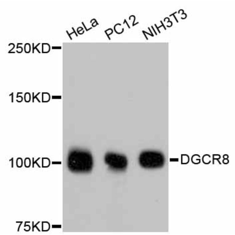 Western Blot - Anti-DGCR8 Antibody (A11404) - Antibodies.com