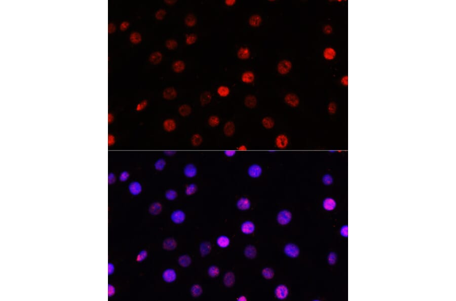 Immunofluorescence - Anti-TCF-4 Antibody (A13309) - Antibodies.com
