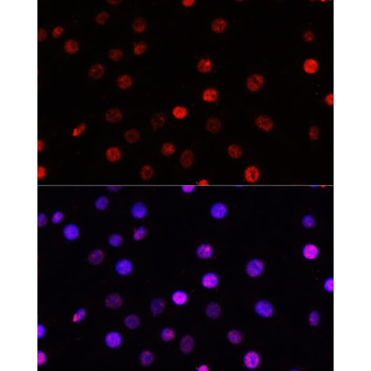 Immunofluorescence - Anti-TCF-4 Antibody (A13309) - Antibodies.com
