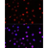 Immunofluorescence - Anti-TCF-4 Antibody (A13309) - Antibodies.com