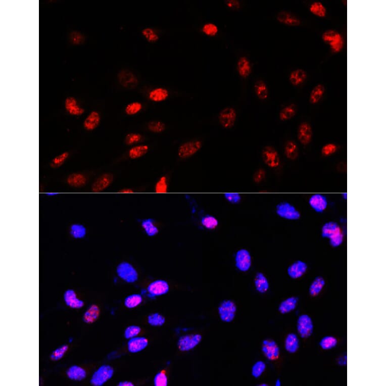 Immunofluorescence - Anti-TCF-4 Antibody (A13309) - Antibodies.com