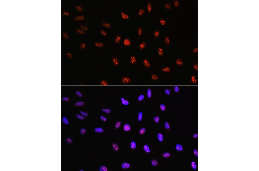 Immunofluorescence - Anti-TCF-4 Antibody (A13309) - Antibodies.com