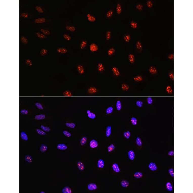 Immunofluorescence - Anti-TCF-4 Antibody (A13309) - Antibodies.com