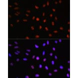 Immunofluorescence - Anti-TCF-4 Antibody (A13309) - Antibodies.com