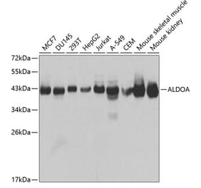 Western Blot - Anti-Aldolase Antibody (A13312) - Antibodies.com