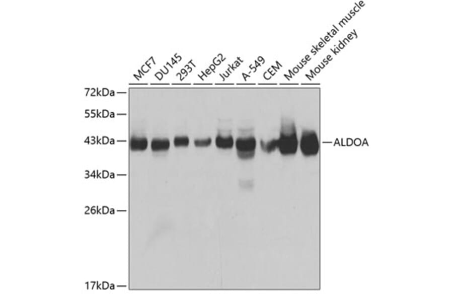 Western Blot - Anti-Aldolase Antibody (A13312) - Antibodies.com