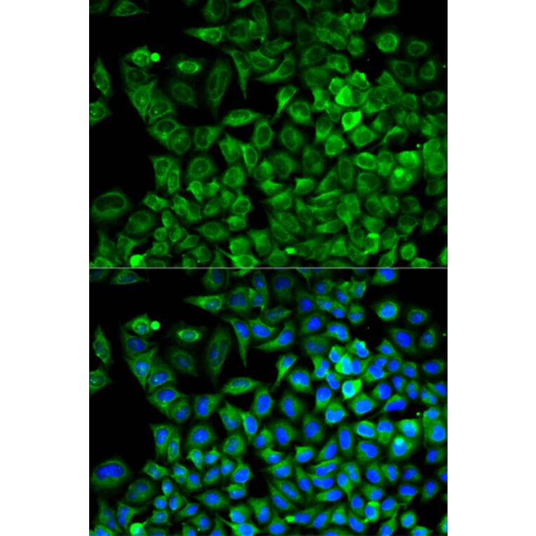 Immunofluorescence - Anti-Aldolase Antibody (A13312) - Antibodies.com