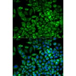 Immunofluorescence - Anti-Aldolase Antibody (A13312) - Antibodies.com