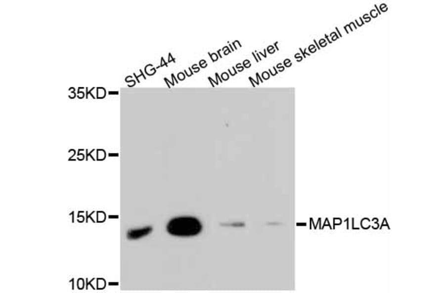 Western Blot - Anti-MAP1LC3A Antibody (A11428) - Antibodies.com