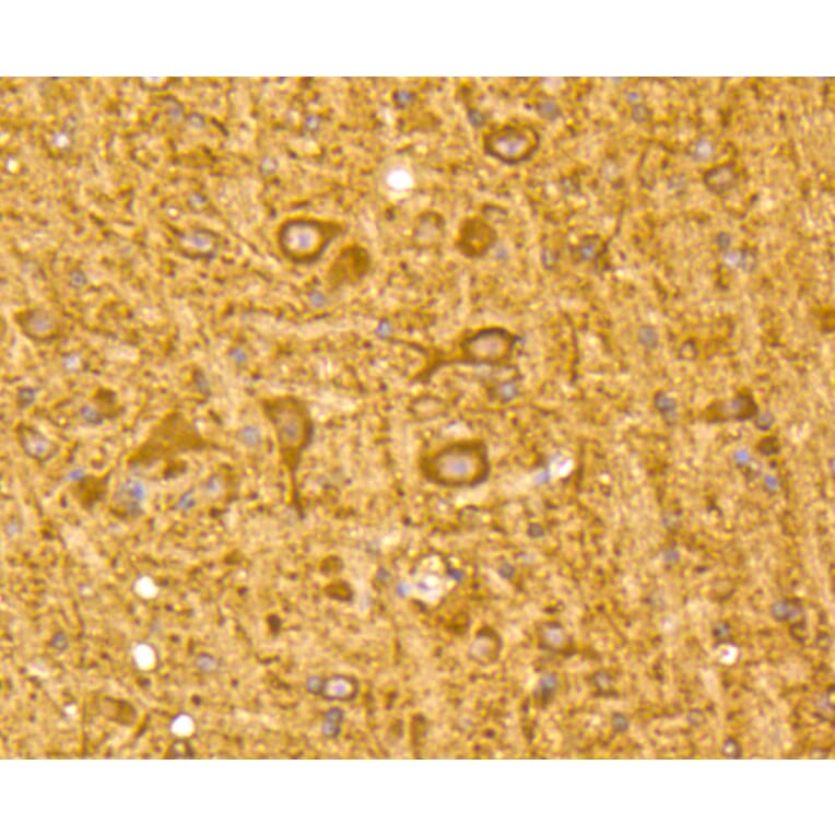 Immunohistochemistry - Anti-MAP1LC3A Antibody (A11428) - Antibodies.com