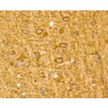Immunohistochemistry - Anti-MAP1LC3A Antibody (A11428) - Antibodies.com