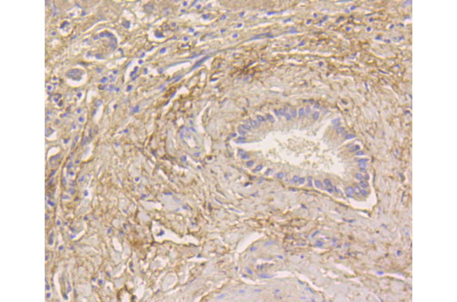 Immunohistochemistry - Anti-MAP1LC3A Antibody (A11428) - Antibodies.com