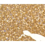Immunohistochemistry - Anti-MAP1LC3A Antibody (A11428) - Antibodies.com
