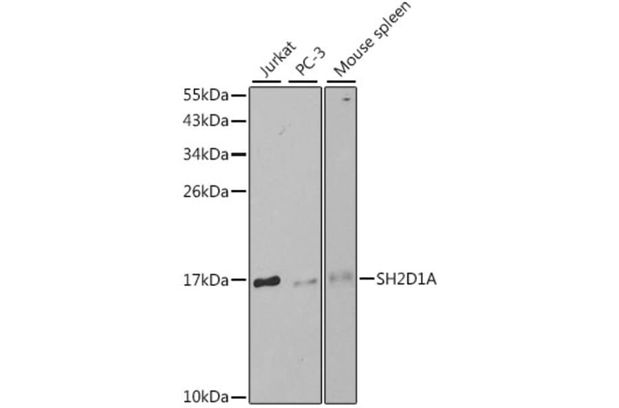Western Blot - Anti-SH2D1A/SAP Antibody (A13314) - Antibodies.com